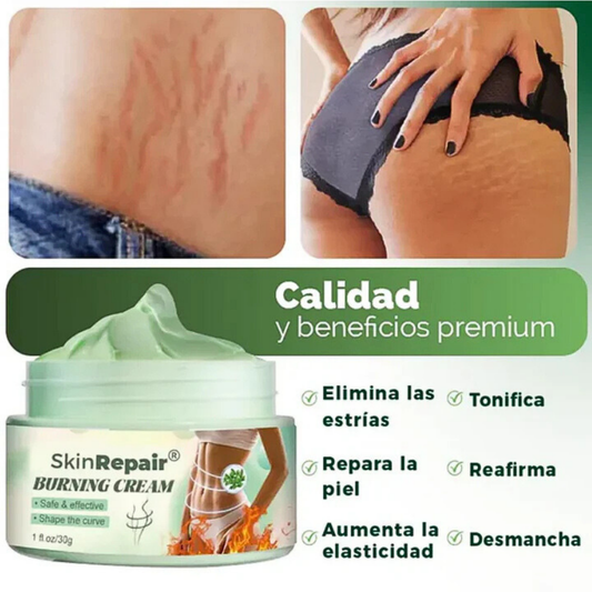 Crema Antiestrías SKINREPAIR - DILE ADIÓS A LAS ESTRÍAS Y EXPERIMENTA CONFIANZA